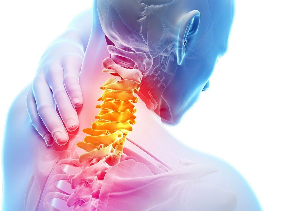 sintomas de osteocondrose espinhal