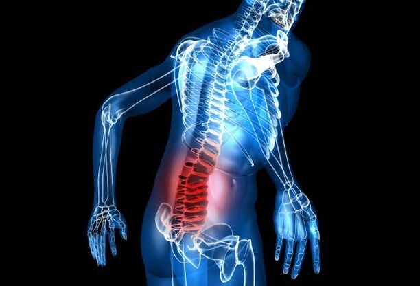 Sintomas de osteocondrose