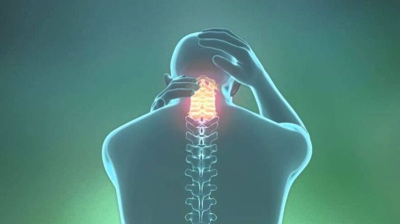 Osteocondrose da região cervical