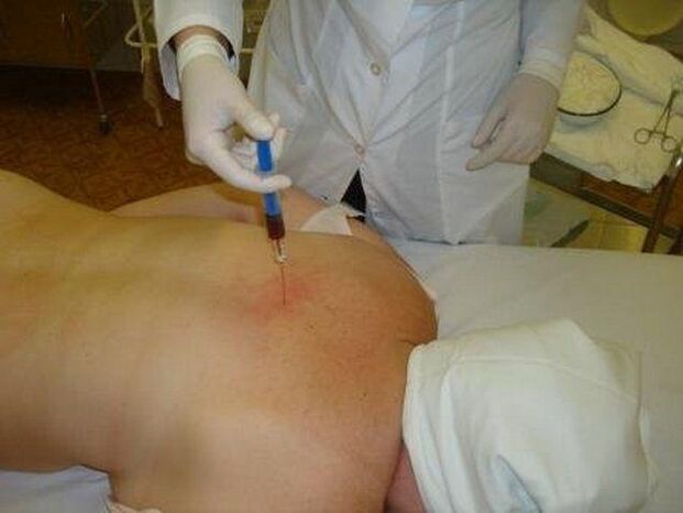 Preparativos para osteocondrose